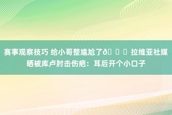 赛事观察技巧 给小哥整尴尬了😅拉维亚社媒晒被库卢肘击伤疤：耳后开个小口子